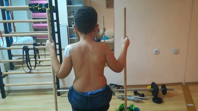 SEAS при сколиоза- Изометрии