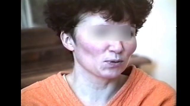 Шизофрения