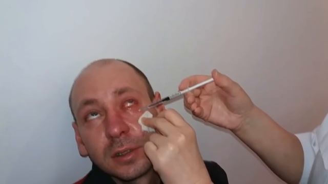 Укол в глаз! Больно или нет?