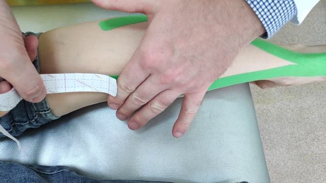 Тейпирование икроножной и камбалвидной мышцы. Taping of the calf and sole muscles.