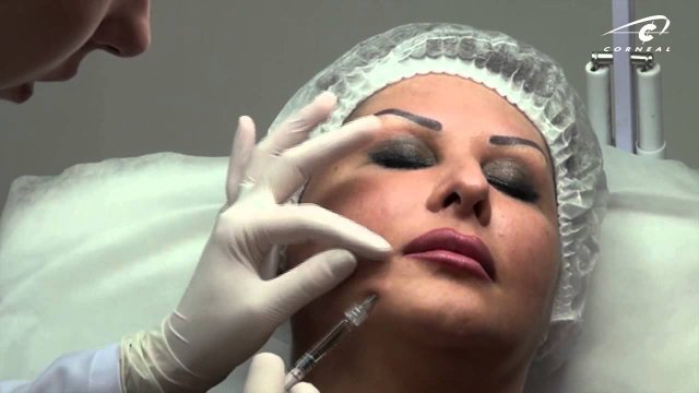 Контурная пластика - сепарация