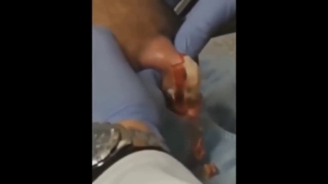 МИР БОЛЬШИХ ПРЫЩЕЙ