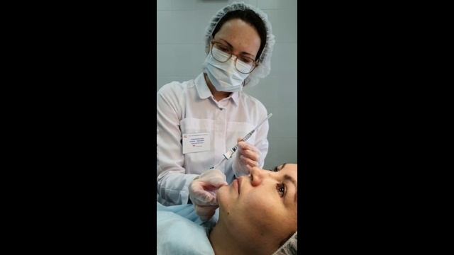 Коррекция морщин марионетки и подбородка