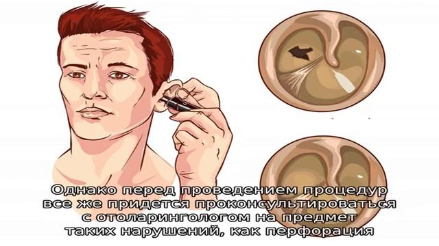 Как избавиться от пробки в ухе