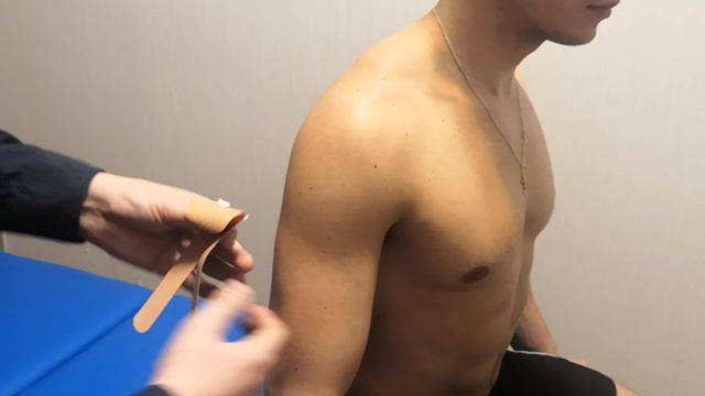 Наложение кинезио тейпа на дельтовидную мышцу