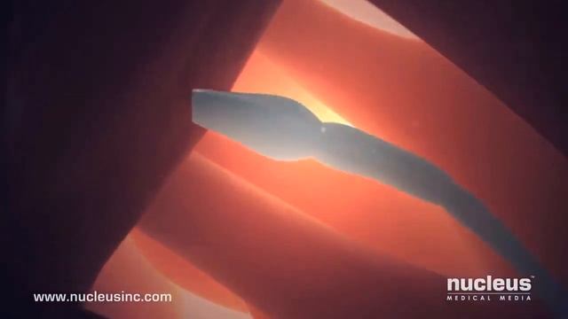 ⛲ ЗАЧАТИЕ РЕБЁНКА (ОПЛОДОТВОРЕНИЕ ЯЙЦЕКЛЕТКИ)