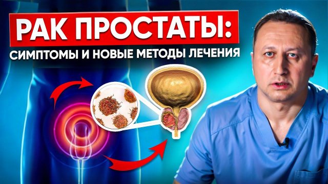 Рак предстательной железы. Симптомы рака простаты, методы лечения и профилактика рака простаты.