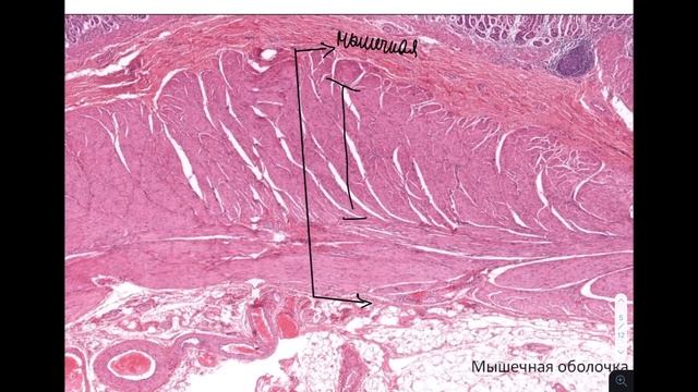 Гистология желудка | Разбор гистологического препарата