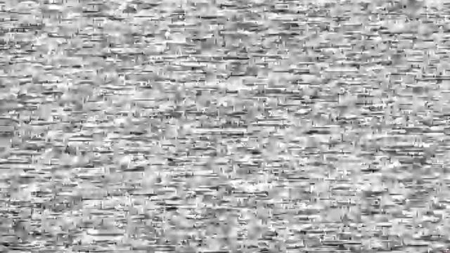 Туберкулома. Торатокальная хирургия легкого © Surgery of the peripheral formations of lung