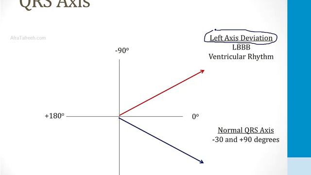 Cardiology - 3. EKGs - 1.EKG Basics atf