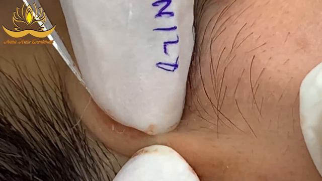 Most Satisfying and Relaxation with An Spa Video #084