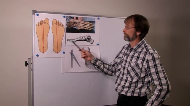 Русская школа ортопедии. Лекция 3. Главные оси стопы