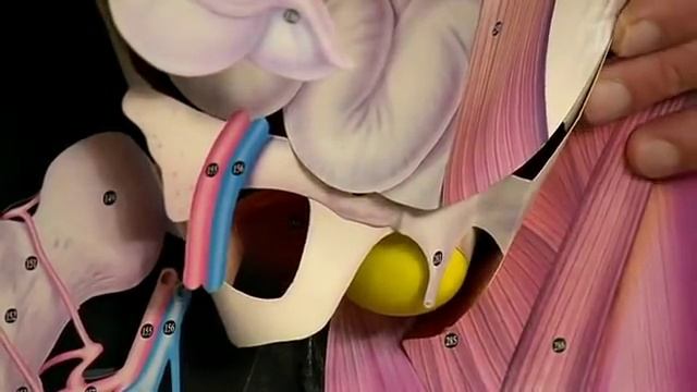 Паховая грыжа. Что это такое