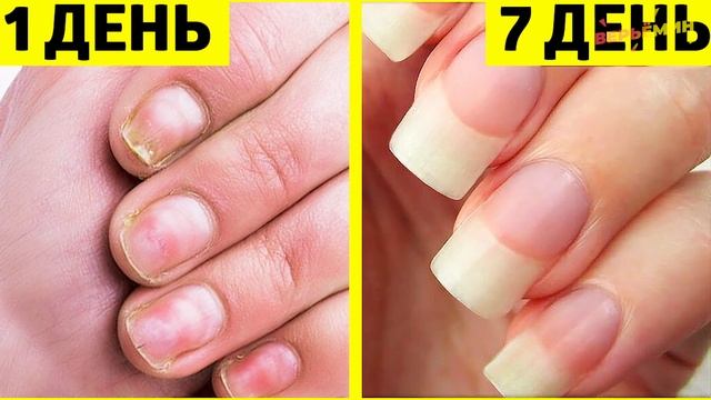 КАК ОТРАСТИТЬ КРЕПКИЕ НОГТИ ВСЕГО ЗА 7 ДНЕЙ