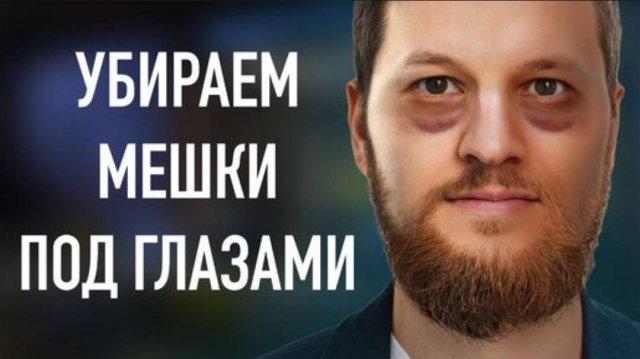 Как убрать мешки под глазами? Правильный уход за лицом