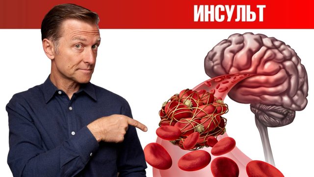 Как предсказать тихий инсульт?🤷♀️