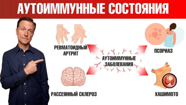 Аутоиммунные заболевания: 7 причин, о которых вы не знали🙌