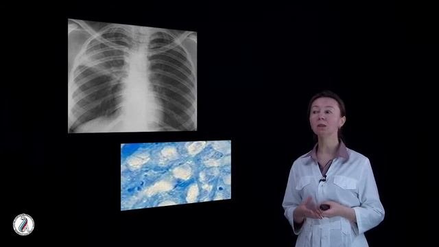 Никишова Е. И.  Туберкулез. Лабораторная диагностика ТЛ