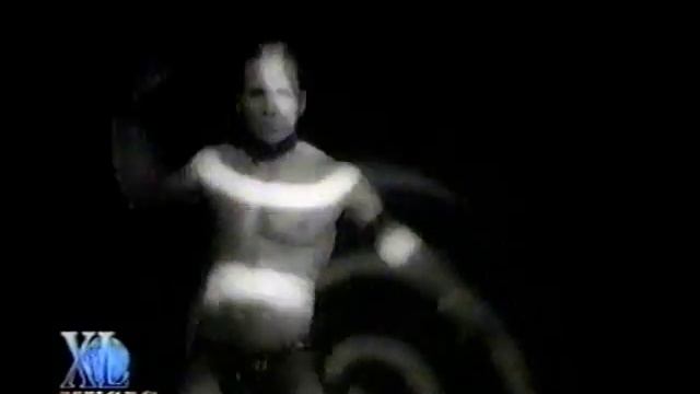 Zona - Por Causa Do Amor