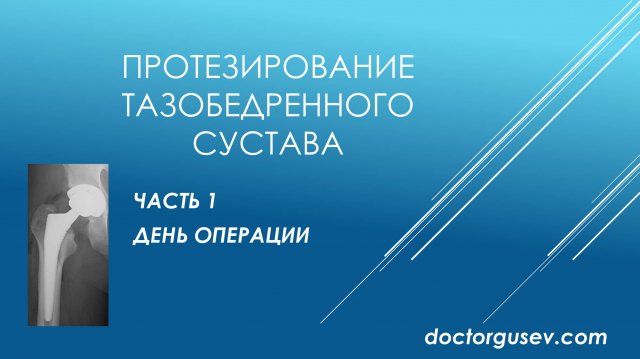 Восстановление и реабилитация после эндопротезирования тазобедренного сустава, часть 1