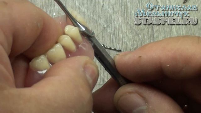 СТОМАТОЛОГИЯ. Как правильно подгибать кламмеры. Как сделать крючки у протеза потуже.