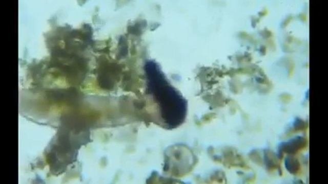 Водопроводная вода под микроскопом! Должен знать каждый!