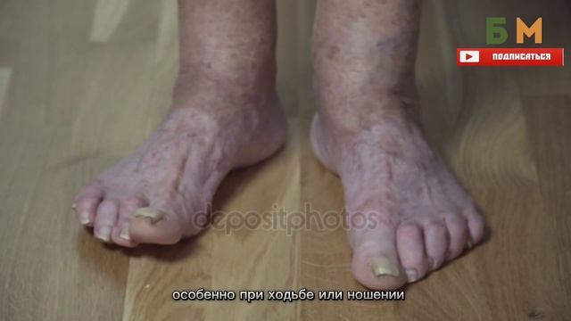 Лучшее средство от Грибка Ногтей. Запомни 1 народный способ как избавиться грибок ногтей