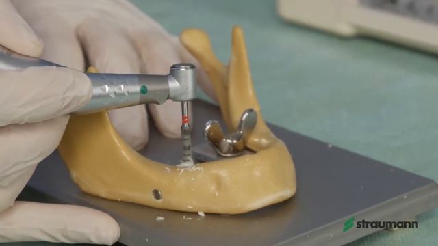 Установка имплантата Straumann BLT
