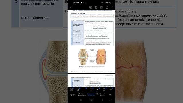 Классификация и характеристика суставов. Анатомия. Артрология