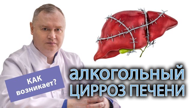 Что такое алкогольный цирроз печени и как он появляется?