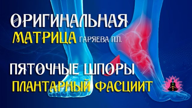 Пяточная шпора» ⚠️ Оригинальная программа матрица по технологии Гаряева ☀️ SoftRadio.ru