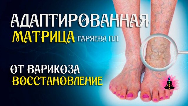 Матрица от варикоза  🌀 Адаптированная программа матрица по технологии Гаряева ☀️ SoftRadio.ru