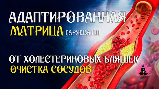 Очистка сосудов от холестериновых бляшек 🌀 Адаптированная программа матрица ☀️ SoftRadio.ru