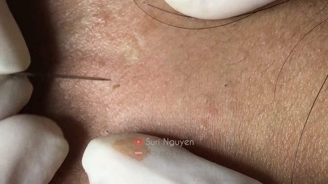 Satisfying and Relaxation with SURI NGUYEN Beauty Spa Video #207