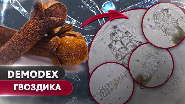 Гвоздика против демодекса - Убьёт ли специя клещей?