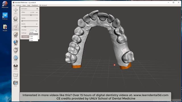 Using Meshmixer to Print Dental Models Vertically