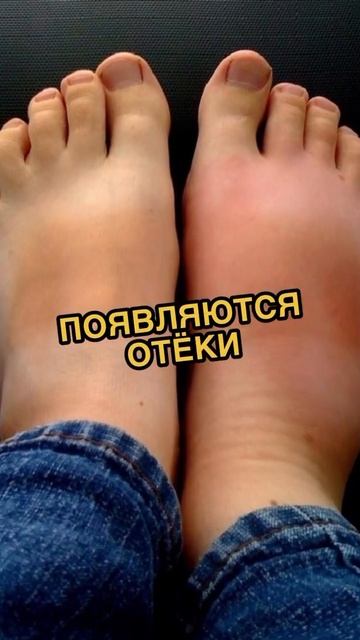 Знали ли вы о существовании ожирения внутренних органов?🫀