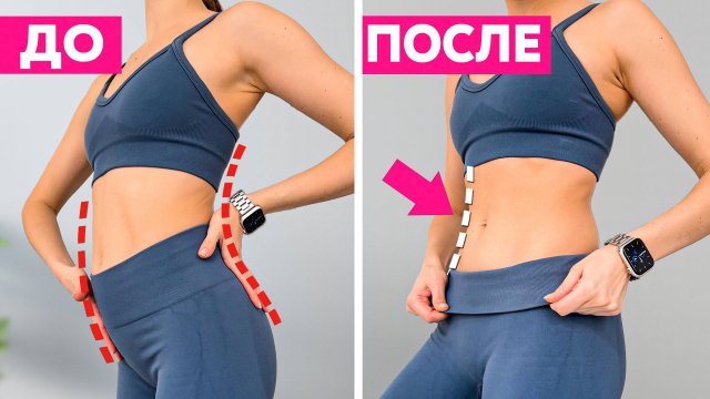 Выпирает живот, гиперлордоз и боль в пояснице? Делай всего ОДНО упражнение