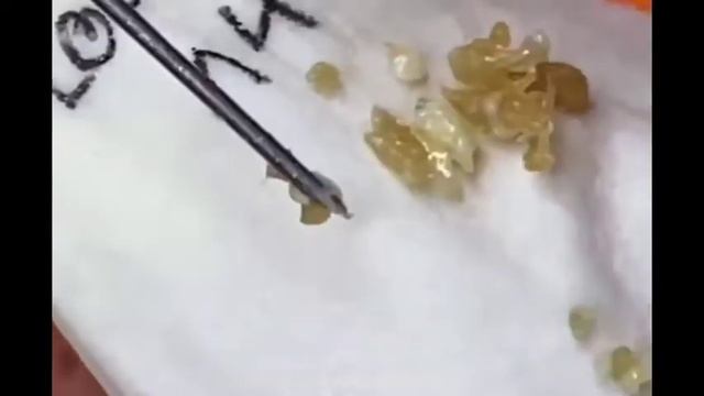 ✅Выдавливание прыщей #1