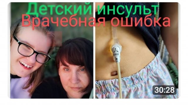 РОСТ ДЕТСКОЙ ИНВАЛИДНОСТИ ИЗ-ЗА ВРАЧЕБНЫХ ОШИБОК🤦♀️НАША ИСТОРИЯ.