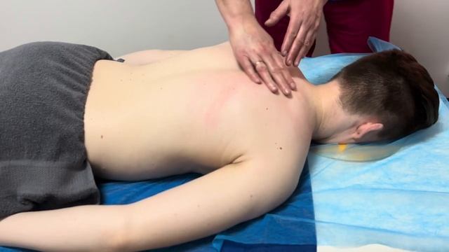 Массаж спины при миофасциальных болях| Back massage for myofascial