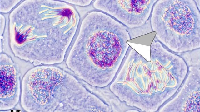 ДЕЛЕНИЕ = ЖИЗНЬ. МИТОЗ. Деление соматической клетки - о?