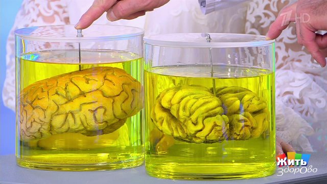 Сам себе доктор. Головной мозг. Жить здорово! Фрагмент выпуска от 20.05.2025