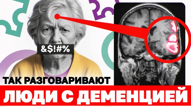 Заметили эти симптомы у близких? СРОЧНО БЕГИТЕ К ВРАЧУ! / 5 неожиданных признаков деменции