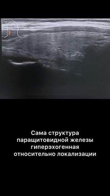 #ощж