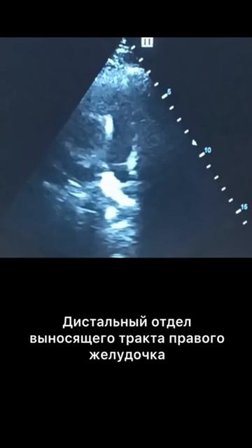 #узисердца