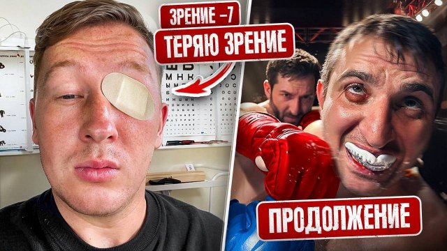 (GERASEV) 9 СЕКРЕТОВ КОТОРЫЕ Я СКРЫВАЮ ОТ ВАС. Продолжение боя РАСУЛ vs МАРСЕЛЬ. Я теряю зрение!
