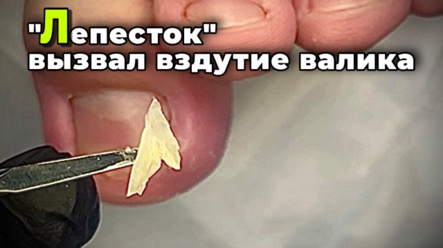 Преображение ногтя. Вернуть все как и должно быть