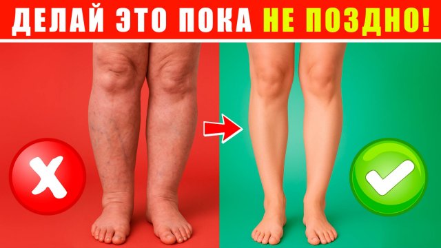 СЕКРЕТ ЛЕГКИХ НОГ! | Сосудистая гимнастика от ОТЕКОВ и УСТАЛОСТИ!
