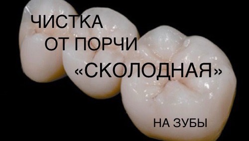 ЧИСТКА ОТ ПОРЧИ СКОЛОДНОЙ (ЗУБНОЙ) 10-08-2025